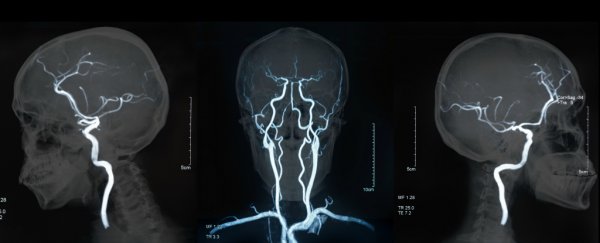 We might have just discovered the missing link between the brain and gut