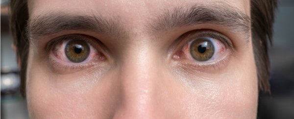Are eye twitches anything to worry about, and what can you do about them?