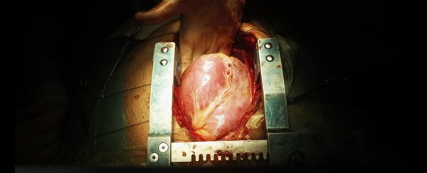 Organs that couldn't be transplanted before are now usable thanks to this life-saving medicine
