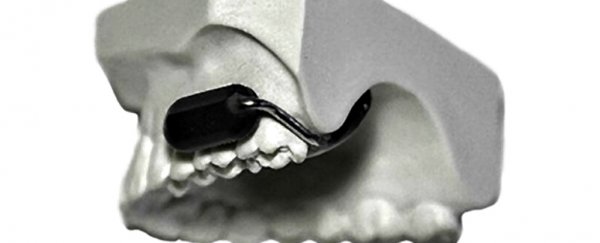 The US military has developed a tooth microphone that's so stealth it's a little unnerving