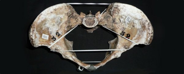 Differences found in women's birth canals are contradicting what evolutionary science told us