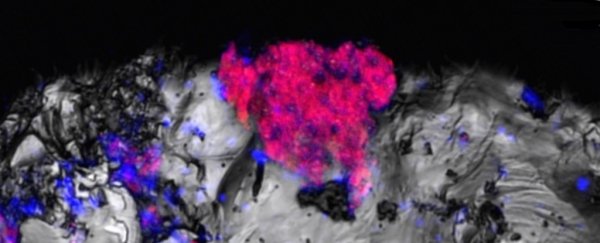 A common bacterium has been discovered thriving in a place where it shouldn't exist
