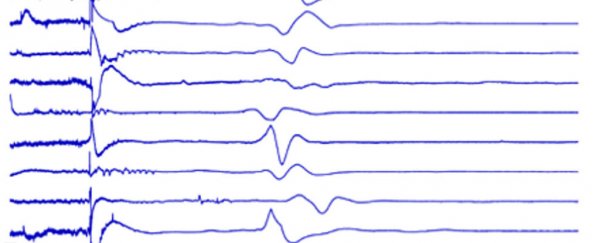 Brain activity has been recorded as much as 10 minutes after death