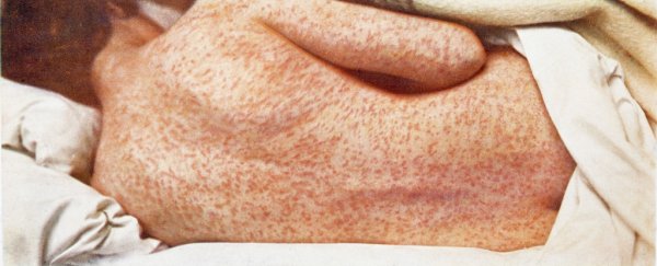 Because of anti-vaxxers, 37 people in Europe have died of measles this year
