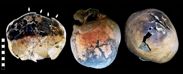 Mount Vesuvius may have killed people by vaporising their blood and exploding heads from the inside