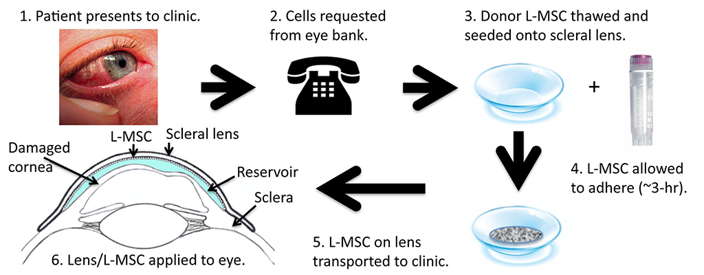 eye contacts band 2