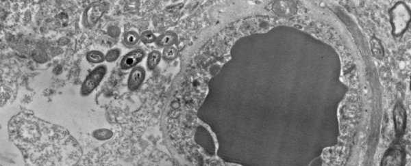 Our brains could actually have bacteria living inside, new evidence suggests