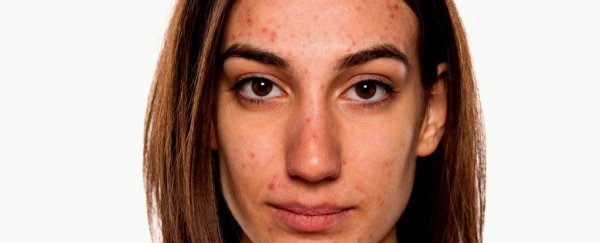 9 things you should never use on a pimple, according to dermatologists, and 2 that might actually work