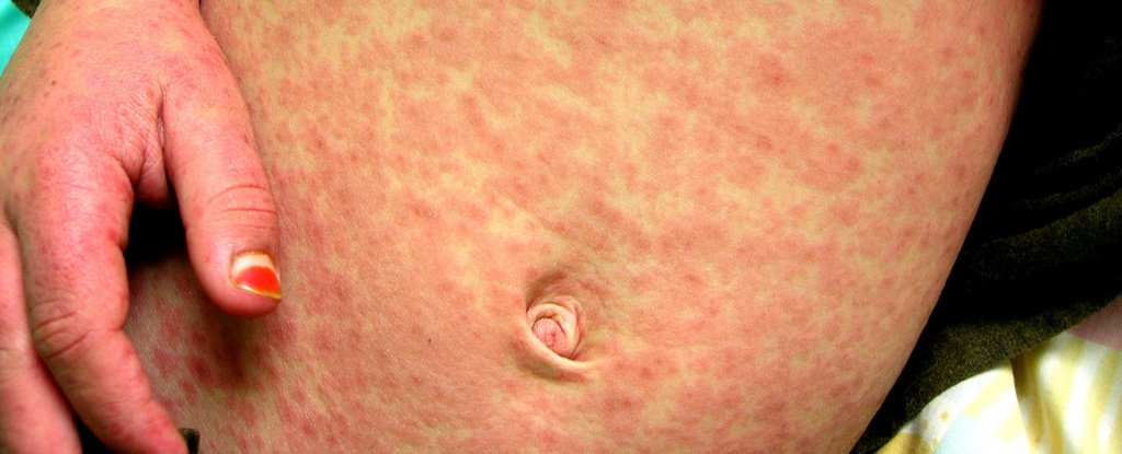 There's Now a 'Vaccine Fatwa' in Indonesia, And Guess What's Happening