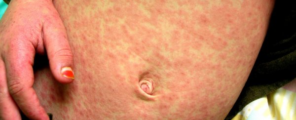 There's now a 'vaccine fatwa' in Indonesia, and guess what's happening