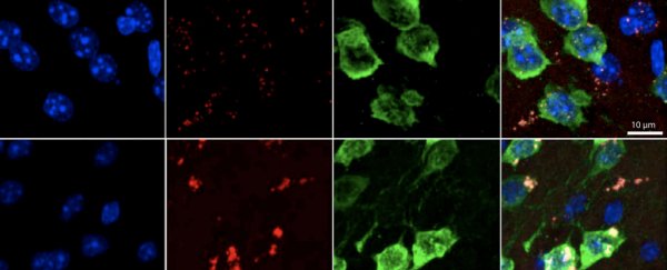 MIT scientists have discovered an unusual sign of aging damage in the human brain