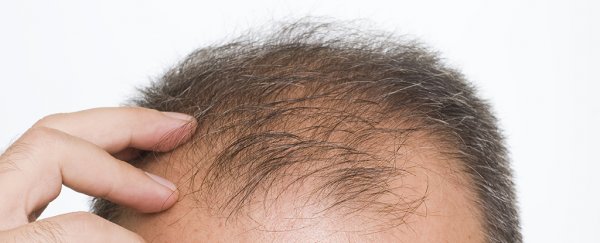 Intriguing new discovery on hair loss in wounded skin could lead us to new treatments