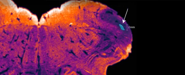 Neuroscientists have discovered a previously hidden region in the human brain
