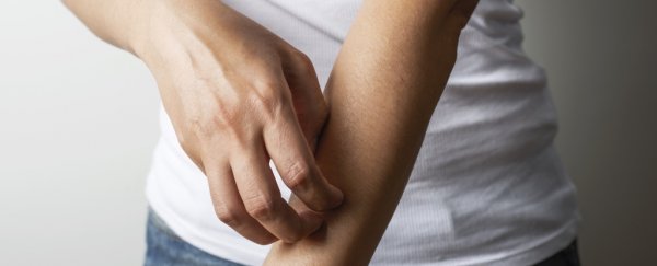 A massive study has exposed the deadly, hidden burden shouldered by eczema patients