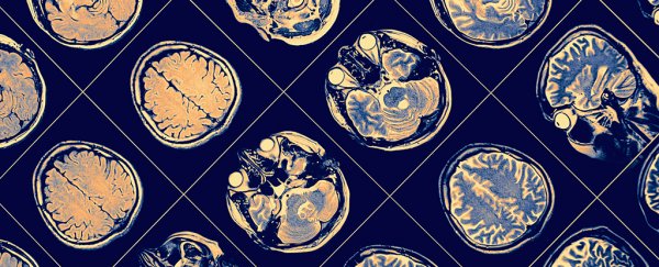 Alzheimer's should be treated as 6 separate conditions, claims new study