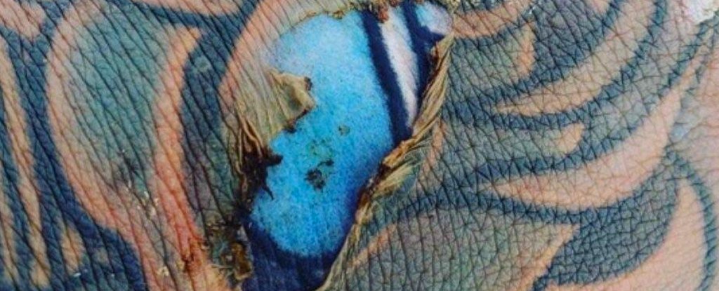 Reddit Users Are at Each Others' Throats Over This Burnt Tattoo Photo :  ScienceAlert