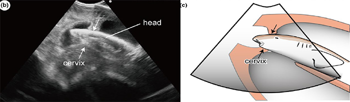 shark cervix open