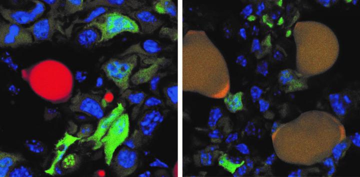 189942 cancer cells to fat cells