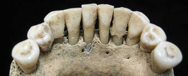 Rare gemstone hidden in ancient teeth reveals a surprising truth about Medieval women