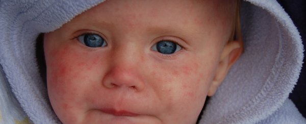 An antivax hotspot near a major US city now has an emergency measles outbreak