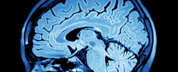 Scientists have found a way to convert human brain signals directly into speech