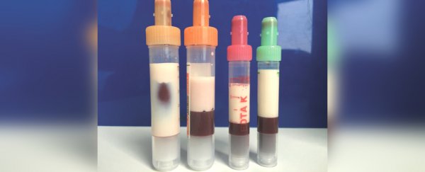 A man's blood was so full of fat, it turned white and almost killed him