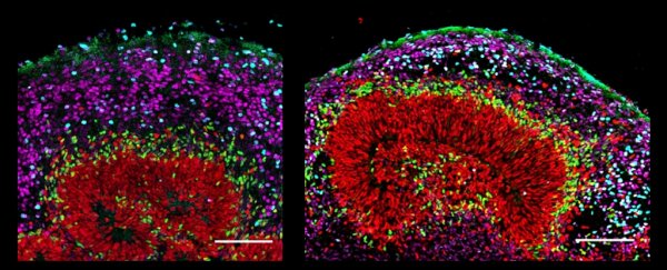 Scientists have grown primate brains-in-a-dish on an unprecedented scale