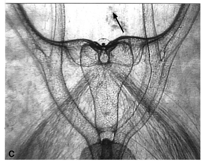 ctenophore anus