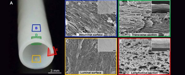 Scientists make blood vessels from cadaver tissues and bring them to life in patients