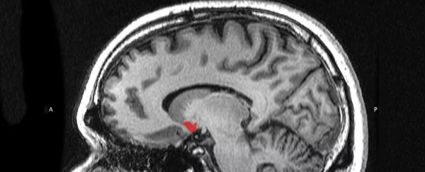Here's what happens to your brain and body if you give up sugar for lent