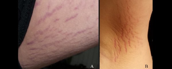 This teen's sudden 'schizophrenia' diagnosis turned out to be... a skin infection