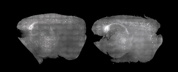 Scientists have 'cleared' Alzheimer's plaque from mice using only light and sound