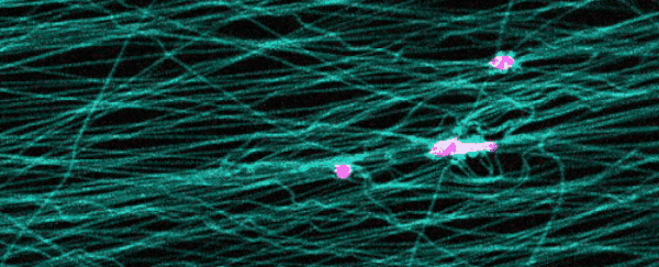 Scientists have captured incredible footage of cells 'slingshotting' in human tissue