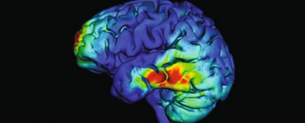 Scientists fixed people's working memory with simple electrical 'zaps' to the brain