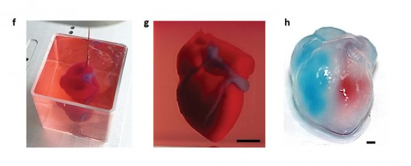 Researchers just 3D printed the first-ever complete heart using human tissue