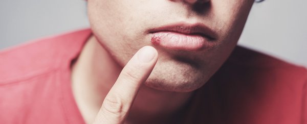 Newly invented application of CRISPR could actually cure herpes one day