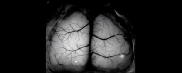 Scientists built a window into mice skulls so we can watch their brains in real-time
