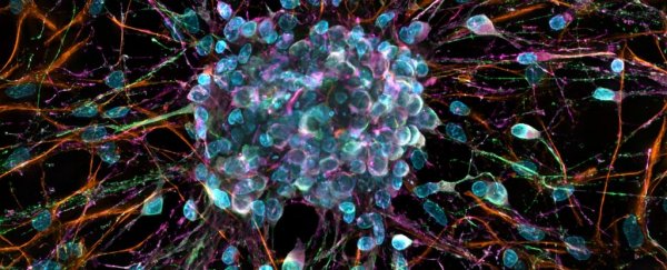Anaesthesia can make nerves grow the wrong way in unborn rats