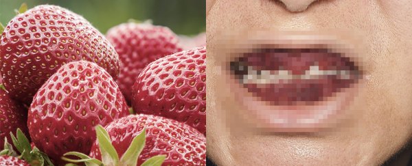 Gruesome medical photo shows rare disease that makes gums look just like strawberries