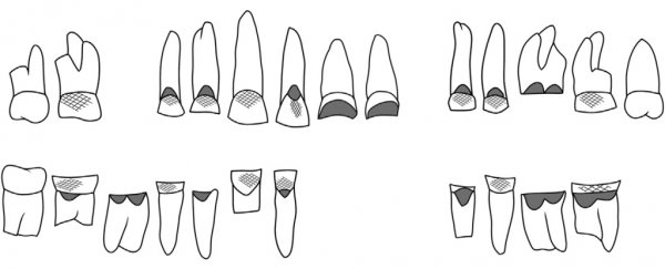 Discovery of an Ancient Egyptian woman's teeth reveals she had a surprising profession