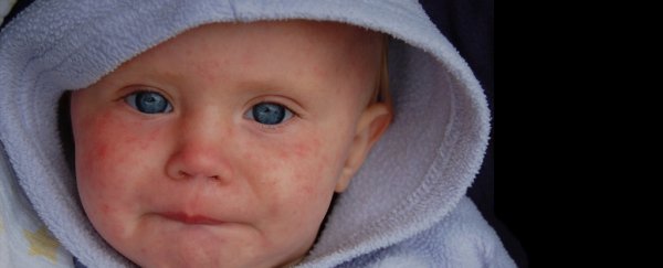Germany proposes massive fines for parents who don't vaccinate kids against measles