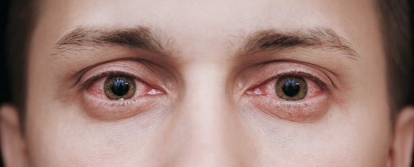Here's why climate change can make seasonal allergies even worse