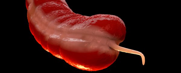 There's a bizarre link between losing your appendix and Parkinson's, huge study shows