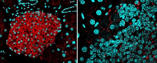 Scientists working with mice just discovered how cells can stop the spread of cancer