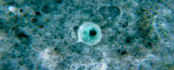 A man went to hospital with a gut parasite. It turned out to be a rare kind of STI