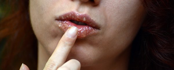 A special type of honey might be just as effective for cold sores as regular creams