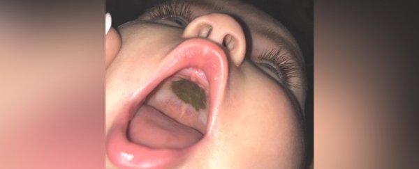 Terrifying dark mark inside baby's mouth turns out to be cardboard