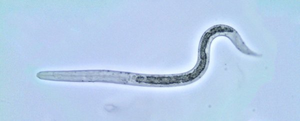 A Woman Had Stomach Pains For 10 Years. The Reason Why Was 1 Foot Long