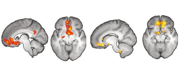 Our imagination really can change our perceptions of reality on a neural level