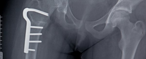 Study finds nearly 400 medical devices, procedures and practices that are ineffective